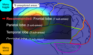 ImageAssist's hints tool on a drawing of the human brain looking at the brain from the side. The various lobes of the brain are listed in the menu. The frontal lobe is recommended and is highlighted on a heatmap superimposed on the diagram.